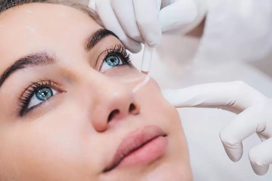 Under Eye Treatment at Aliva Aesthetics Vijayawada