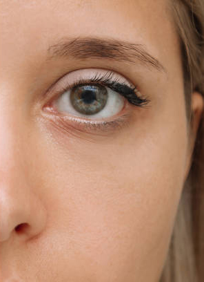 After treatment