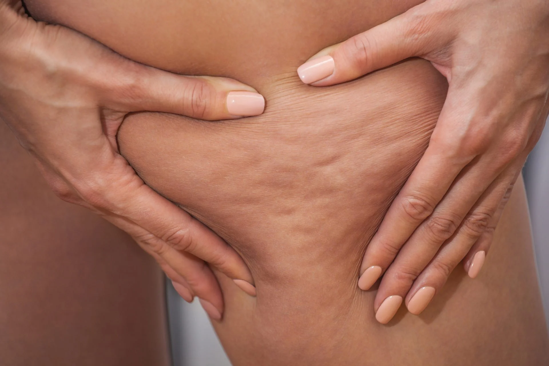Anti-cellulite body therapy treatment