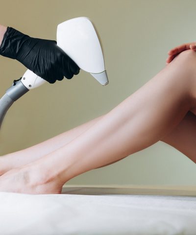 laser hair removal treatment in vijayawada