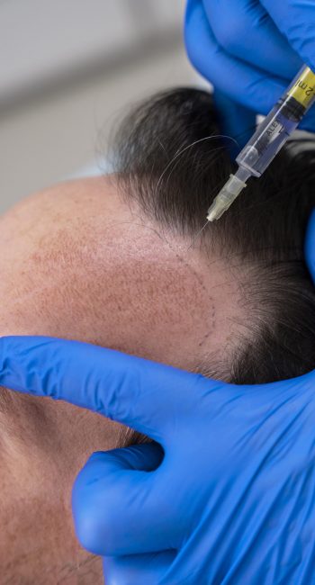 GFC HAIR TREATMENT